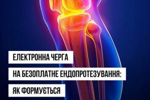 ЕЛЕКТРОННА ЧЕРГА НА БЕЗОПЛАТНЕ ЕНДОПРОТЕЗУВАННЯ: ЯК ФОРМУЄТЬСЯ