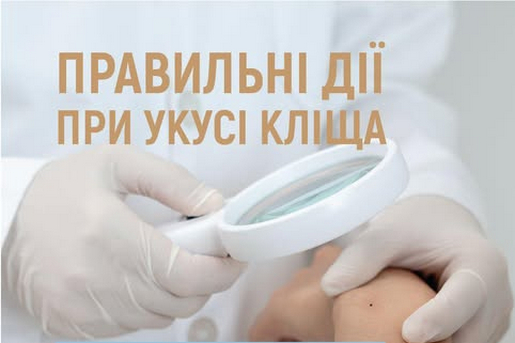 ПРАВИЛЬНI ДII ПРИ УКУСI КЛIЩА